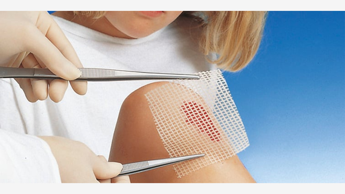 The ointment dressing Grassolind keeps wound margins and wound surfaces soft and supple and protects the wound from drying out.