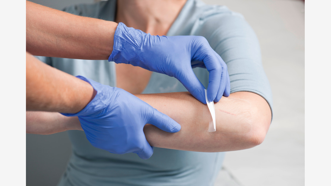 <P>&nbsp;Hydrofilm safely protects the wound from secondary infections and physical irritants.</P>