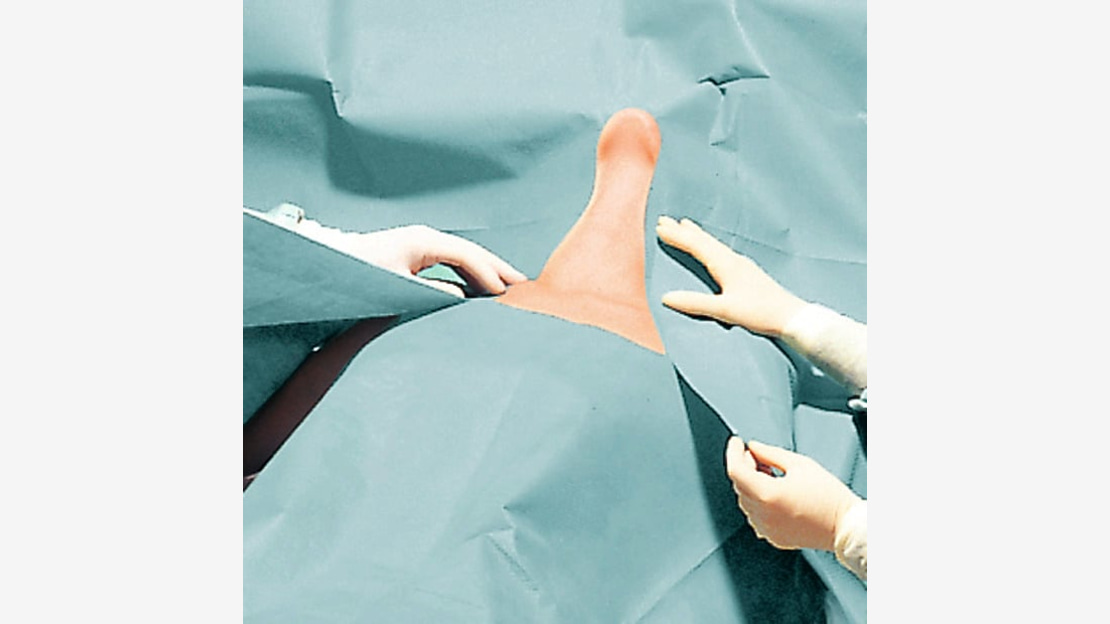 Foliodrape Slit Sheet Set surgical application