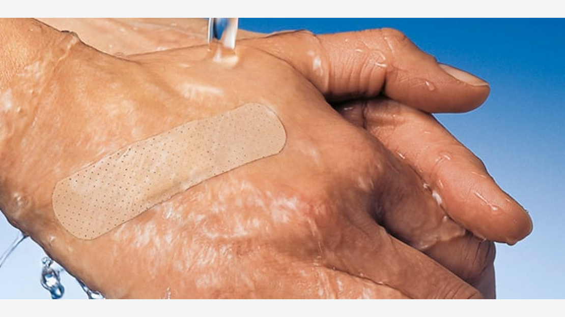 Picture: wadhing hand with a plaster