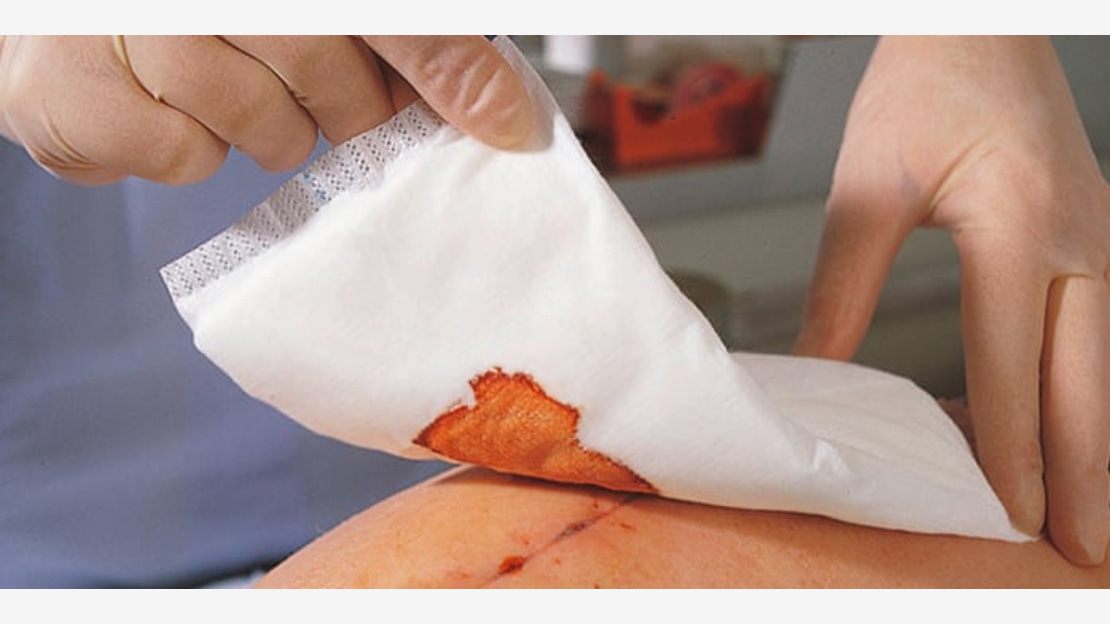 Zetuvit absorbent pad in use