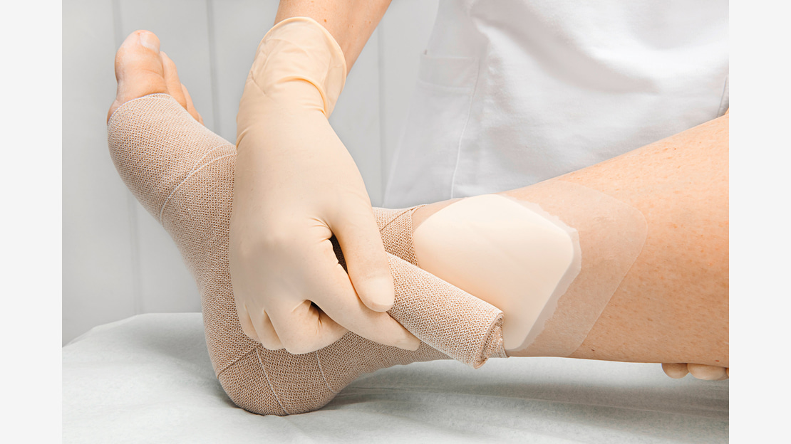 HydroTac comfort + Pütter Application