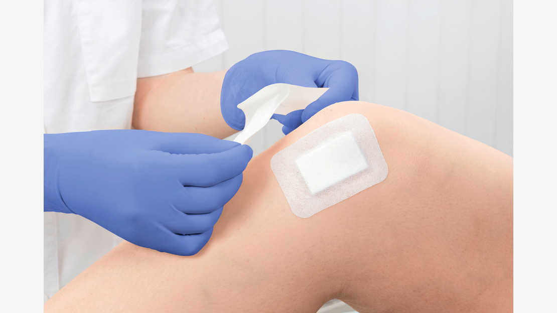 Anwendung Cosmopor Advanced