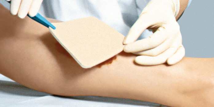 Due to the special pore structure PerrmaFoam takes up detritus as well as slough and viscous exudate from the wound and enables a fast and effectivfe wound cleansing.