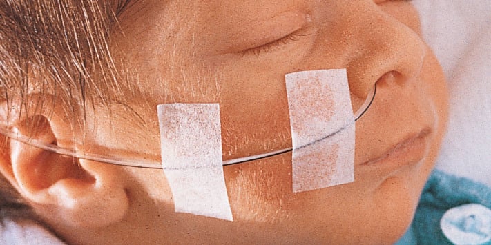 For a particularly gentle fixation, the extremely permeable to air and water vapour Omnipor® is used.