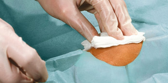 Surgery