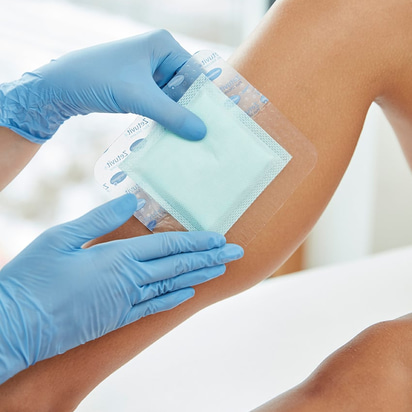 Zetuvit Plus Silicone Border in der Anwendung