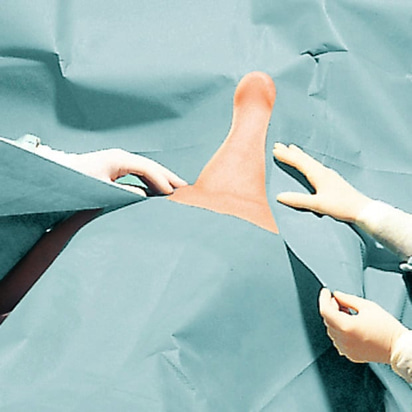 Foliodrape Slit Sheet Set surgical application