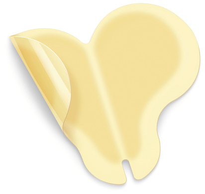 150618_Hydrocoll_2_sacral_application