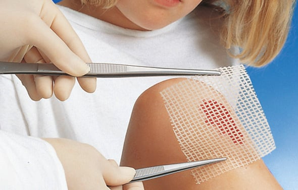 The ointment dressing Grassolind keeps wound margins and wound surfaces soft and supple and protects the wound from drying out.