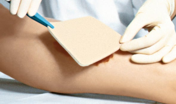 Due to the special pore structure PerrmaFoam takes up detritus as well as slough and viscous exudate from the wound and enables a fast and effectivfe wound cleansing.