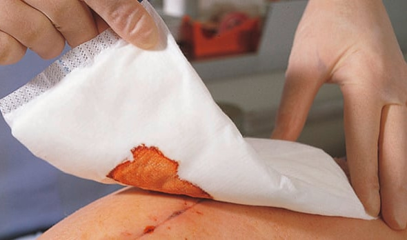 Zetuvit absorbent pad in use