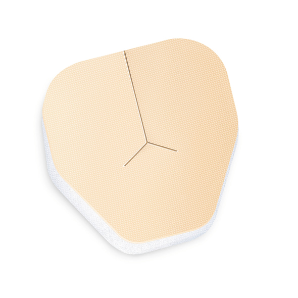 143737_PermaFoam_classic_tracheostomy_application