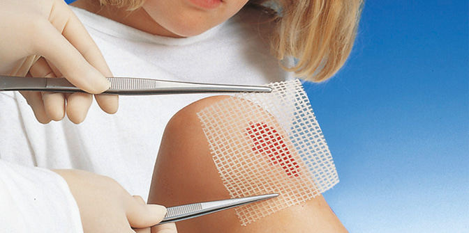 The ointment dressing Grassolind keeps wound margins and wound surfaces soft and supple and protects the wound from drying out.